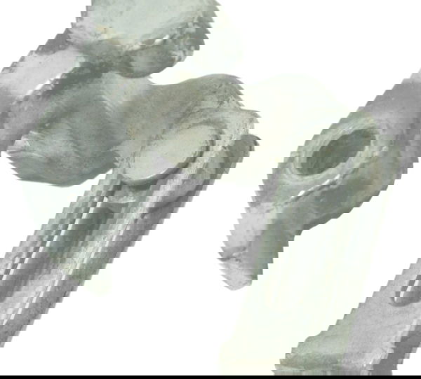 Suporte Cabo Freio Yamaha Ybr 150 Factor 14-20 Original