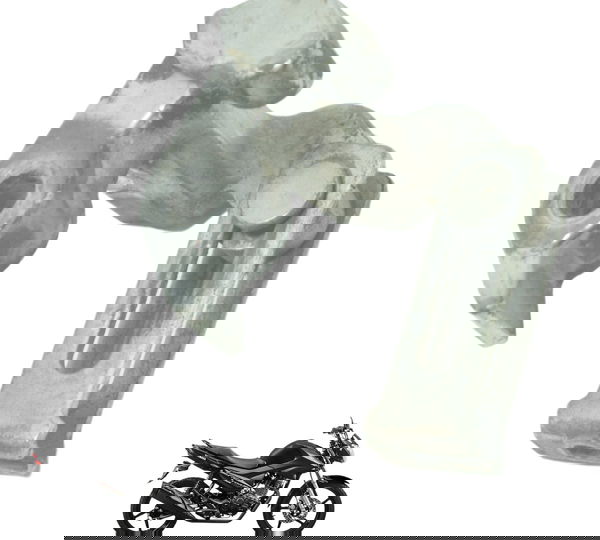 Suporte Cabo Freio Yamaha Ybr 150 Factor 14-20 Original