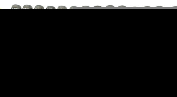 Kit Parafusos Motor Bmw G310 Gs 20-24 Original