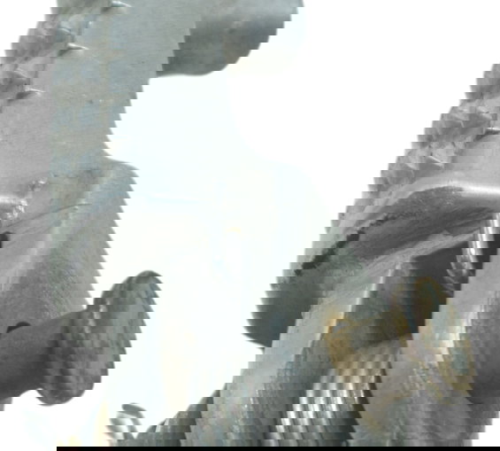 Pedaleira Dianteira Dir Avaria Honda Cbr 1000 Rr 08-11 Orig