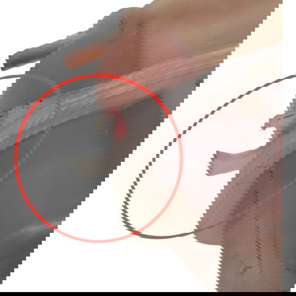 Reservatorio Agua Radiador Motor Fiat Siena 1.0 2009 Detalhe