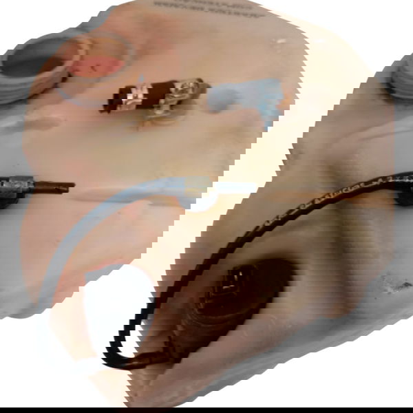 Reservatorio Partida Frio Volkswagen Voyage 1.6 2014 2015